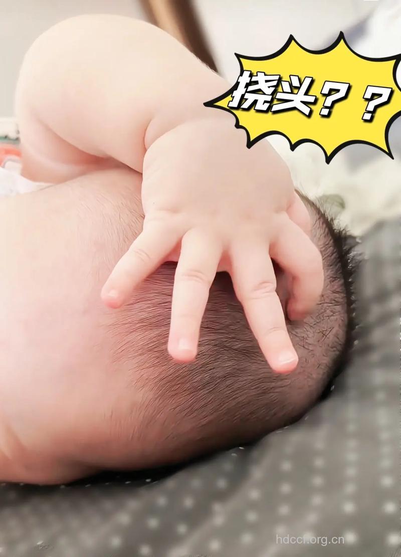 常脑挠头能防病