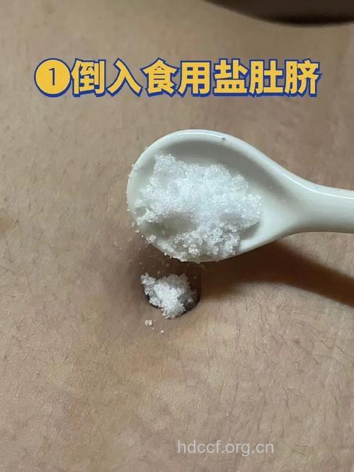 艾炷隔盐灸法治疗腹泻的方法
