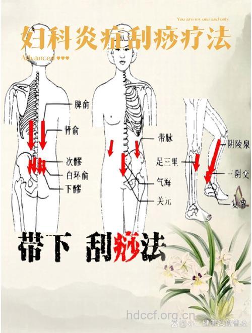 怎么刮痧治疗慢性盆腔炎