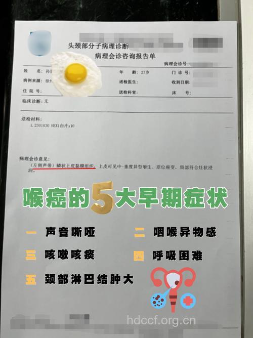 声音嘶哑小心恶性肿瘤