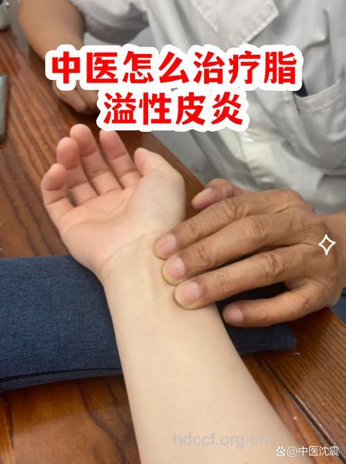 中医怎么推拿治疗脂溢性皮炎