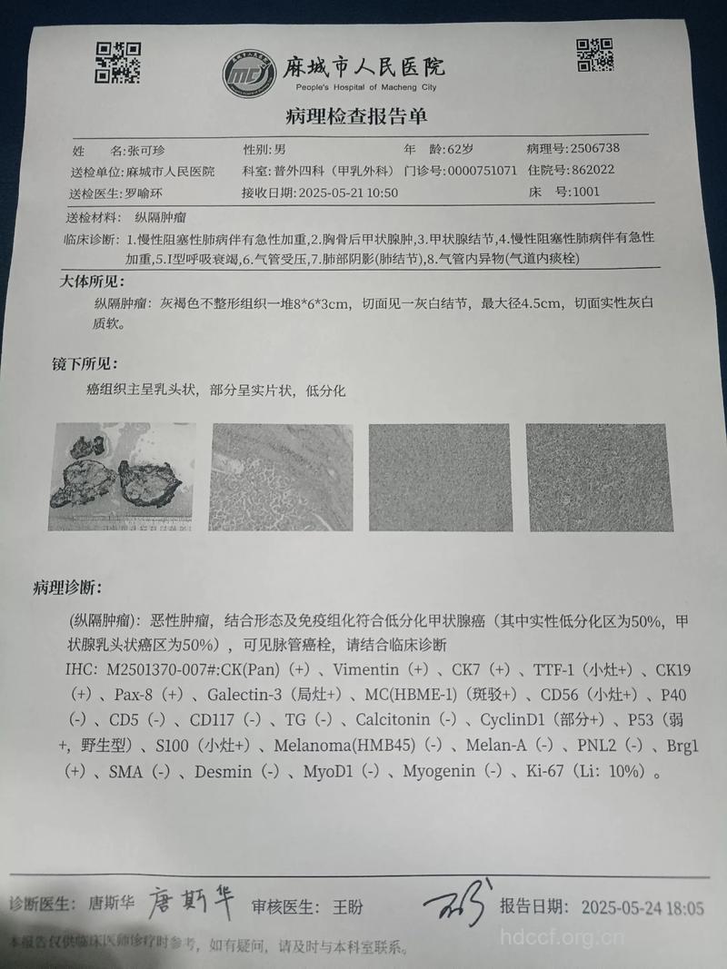 癌细胞水平诊断有新的进展