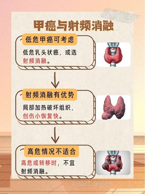 甲状腺癌的病因和病理