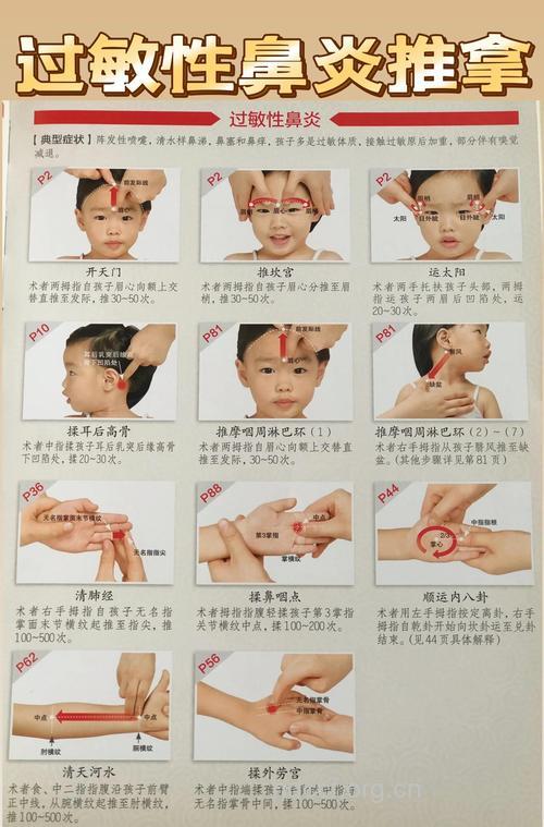 中医怎么拔罐治疗过敏性鼻炎