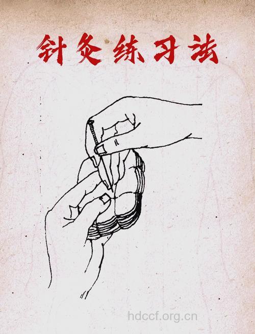中医怎么针灸促醒植物人