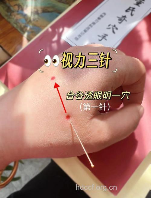 中医怎么针灸治疗色盲