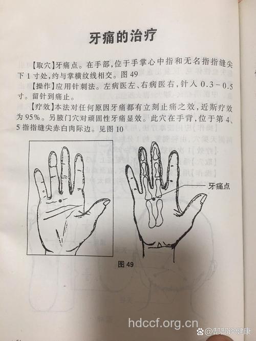 中医怎么针灸辩证治疗牙痛