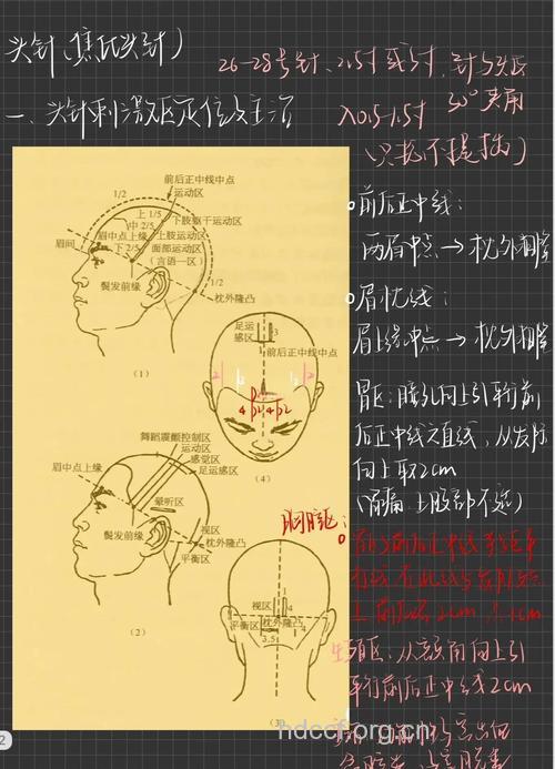 怎么针灸治疗神经麻痹