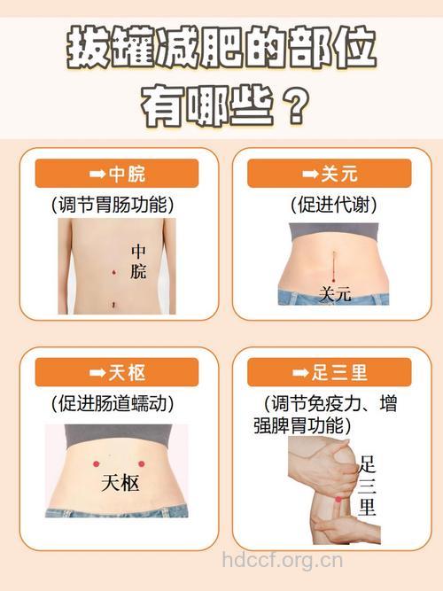 中医怎么有哪些拔罐减肥