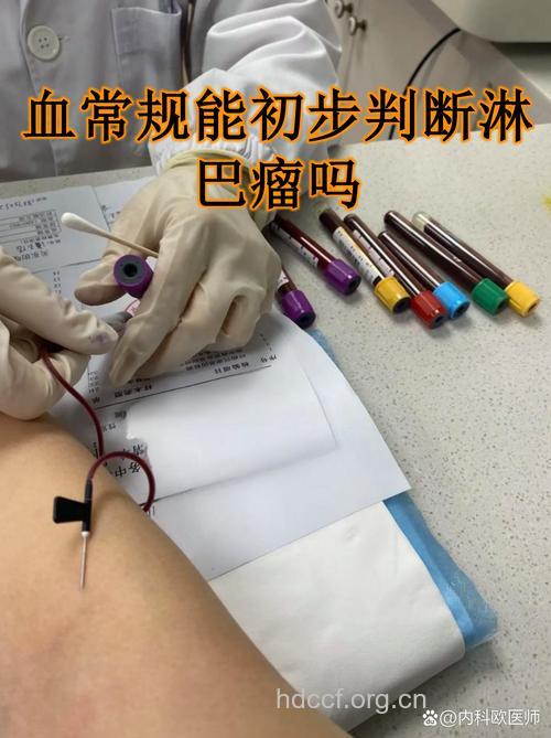 “鸡尾酒式”检查淋巴瘤