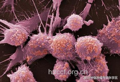 50个细胞既可检出癌症