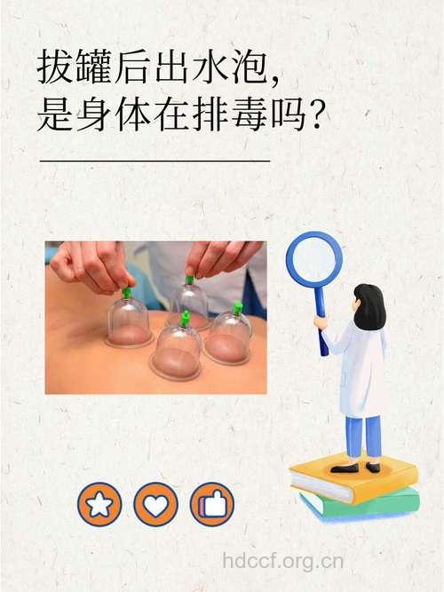 你知道什么是中医发泡罐