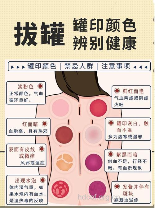 中医拔罐有哪些适应症