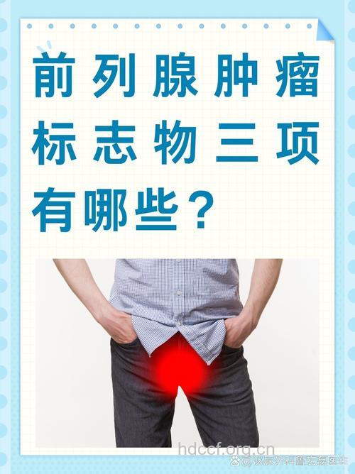 揭秘:更好的前列腺癌标志物