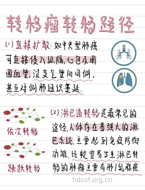 预防癌症扩散与转移是根治的条件