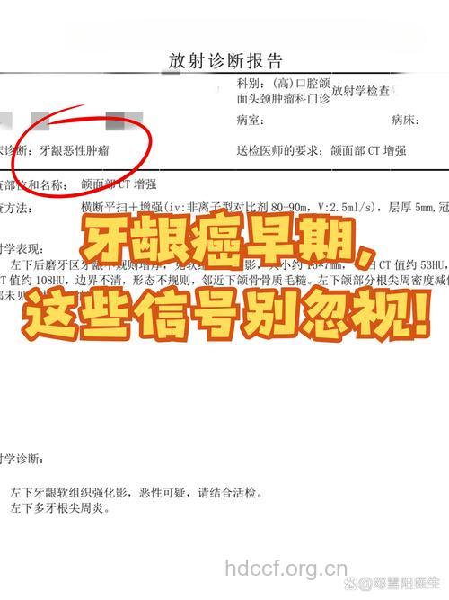 牙齿上有哪些癌症信号