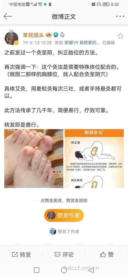 艾灸如何治疗胎位不正