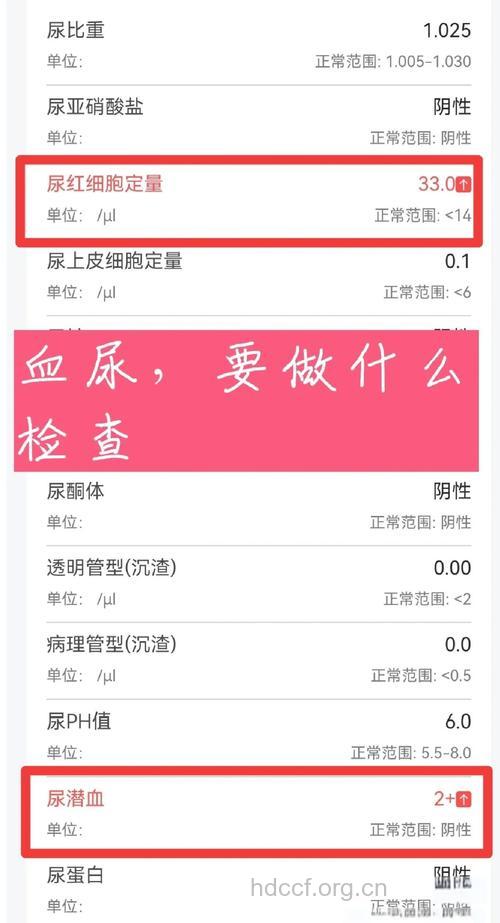 检查血尿有没有新方法?