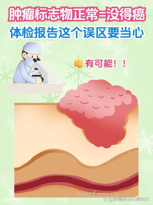 体检有陷阱 小心肿瘤当炎症