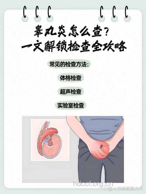 睾丸炎如何检查 推荐5个方法