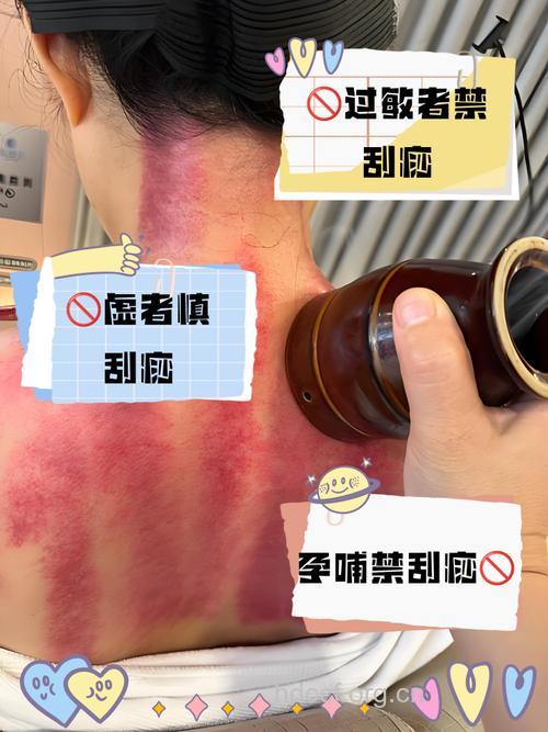 哪些人不适宜刮痧？