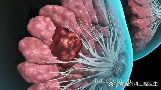 睡床垫竟然也会导致乳腺癌?