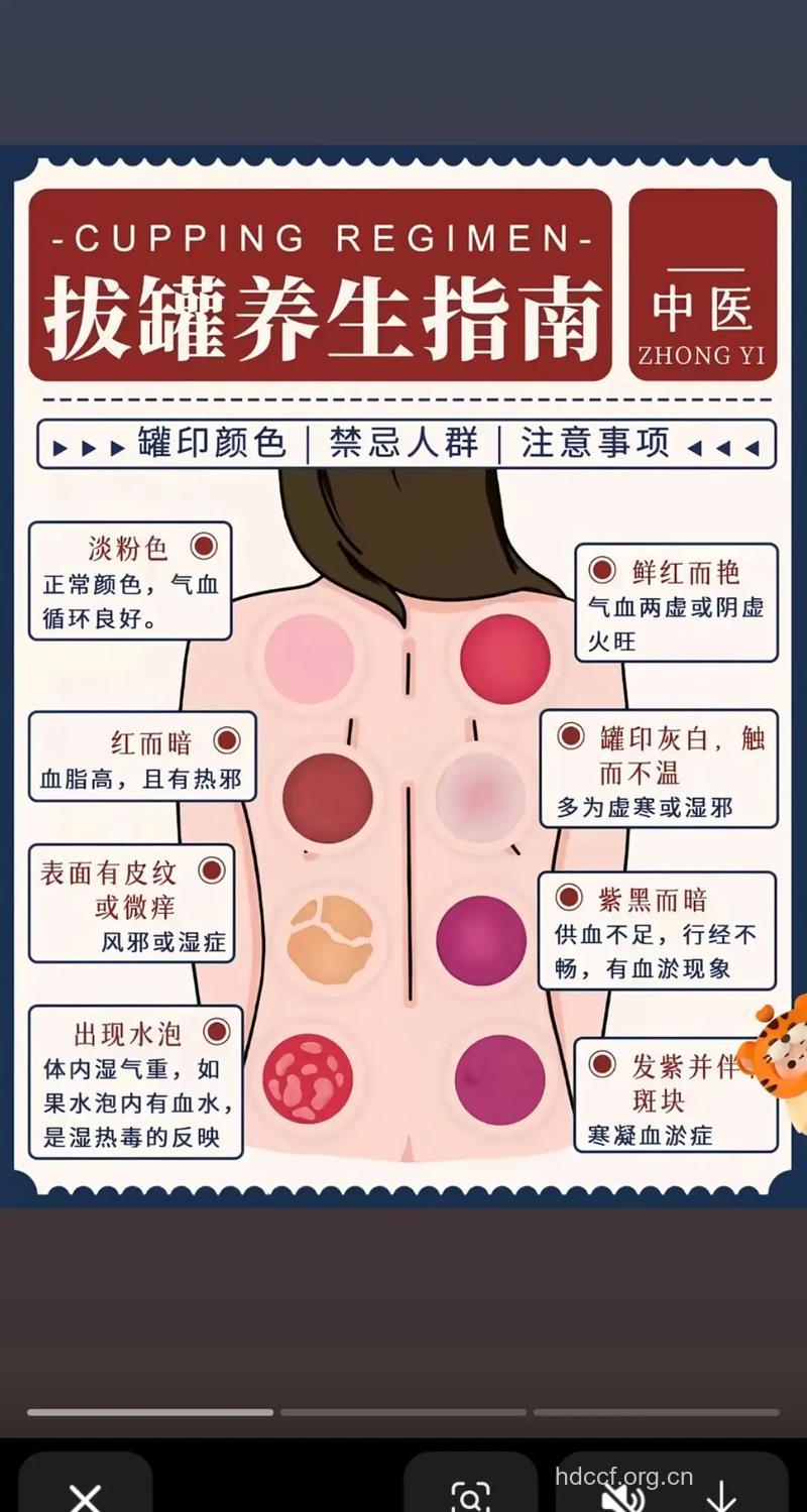 拔火罐如何治疗慢性鼻炎?