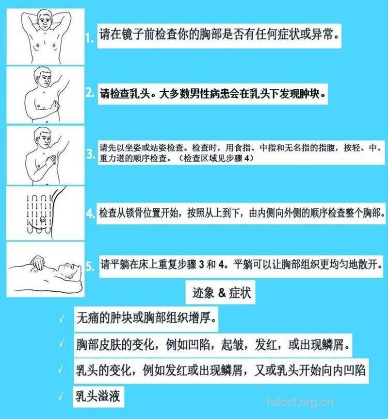6种检查男性乳腺癌的方法