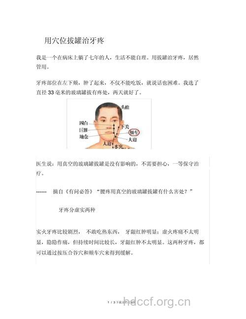 如何用拔火罐治疗牙痛