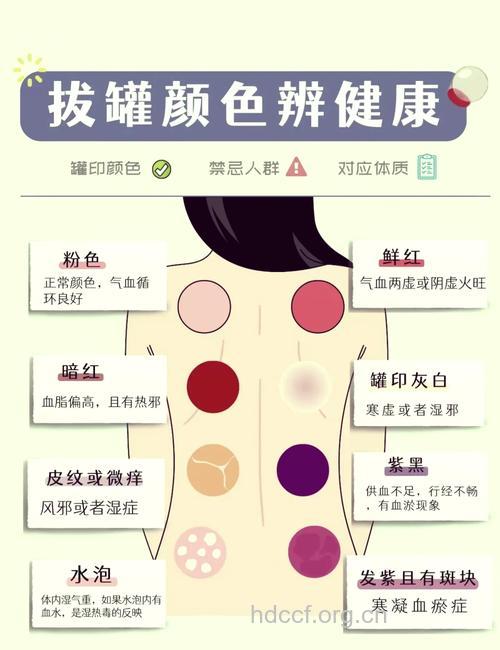 有哪些不同的拔罐方法？