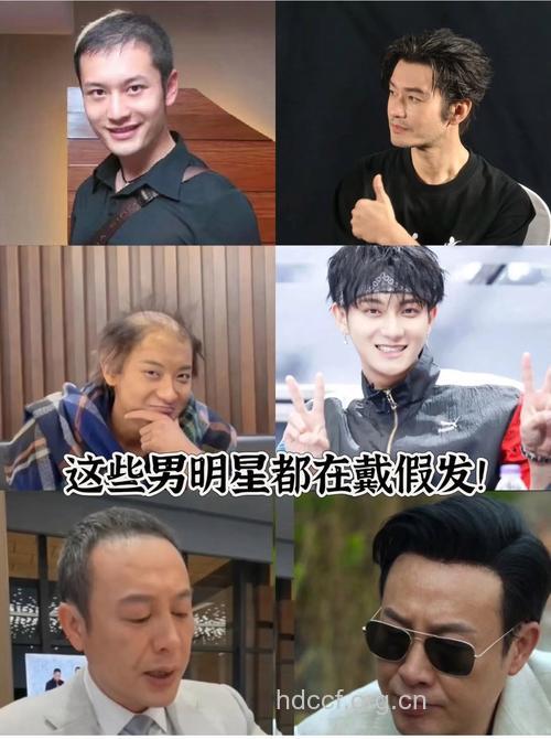 七大预防脱发的明星