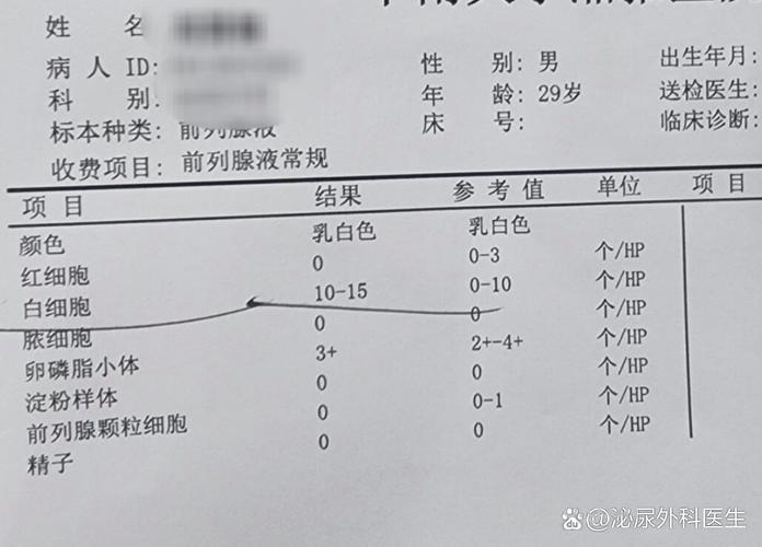 男性前列腺炎检查项目