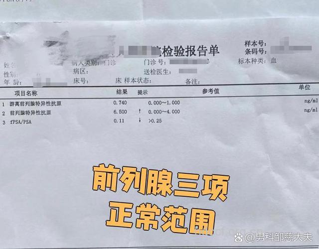 前列腺炎的检查项目