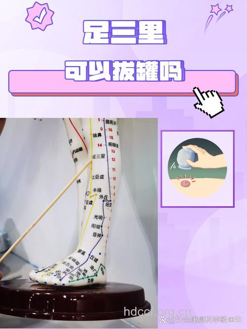 中医拔罐可以瘦小腿吗