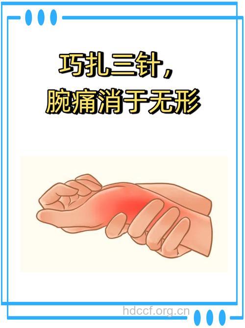 针刺镇痛不失为一种好的治疗方法