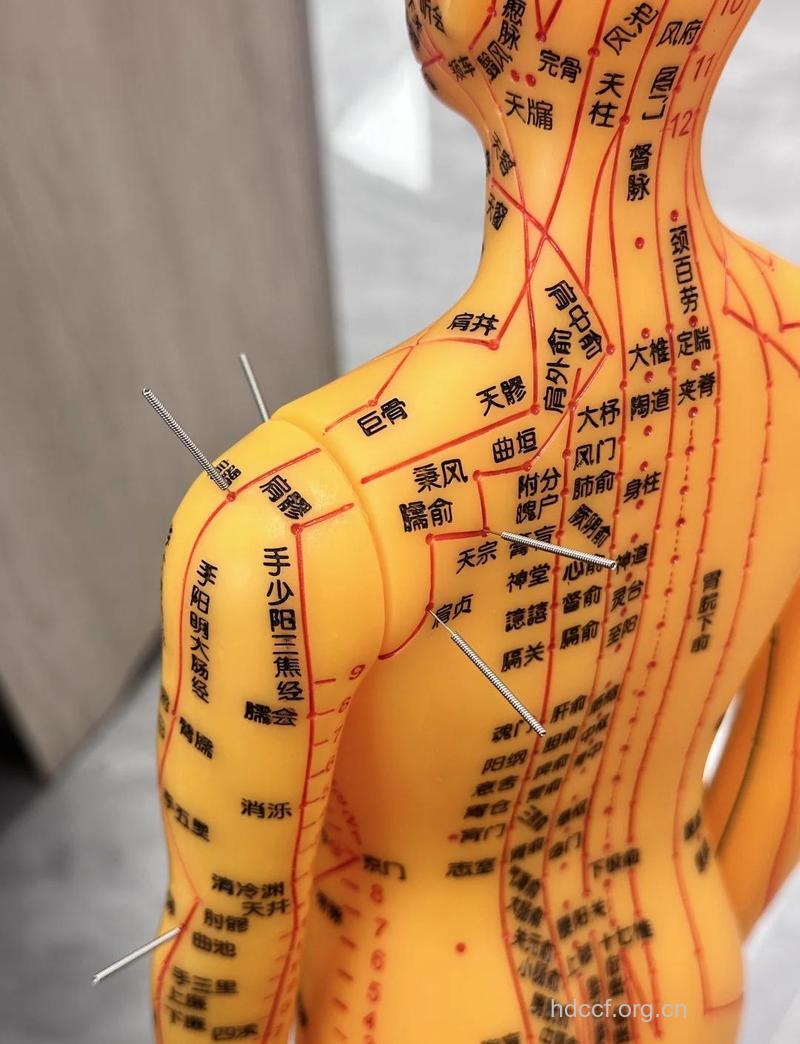 针灸保健穴位都有哪些？