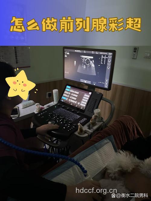 前列腺有什么超声检查