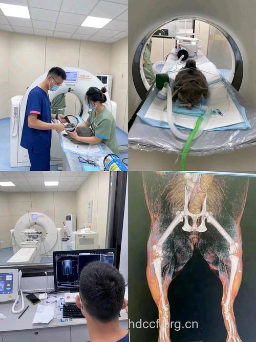 男科体检为什么要进行CT检查