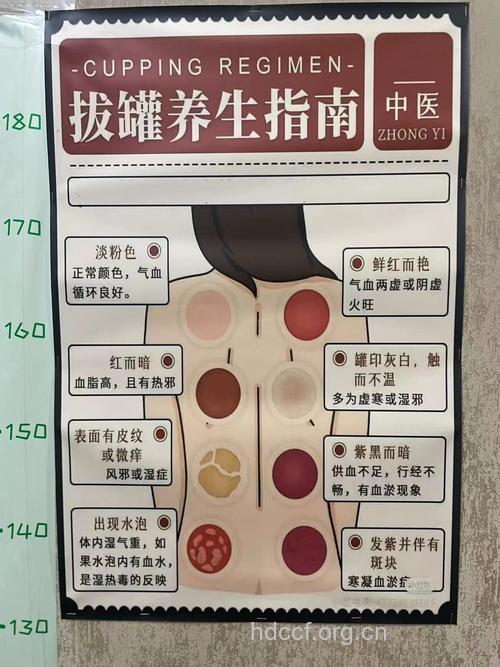 中医拔罐的8大注意事项
