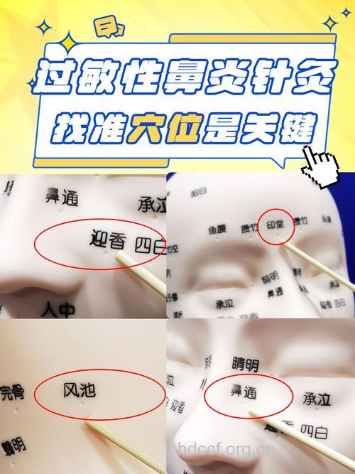 针灸为什么会过敏？如何预防