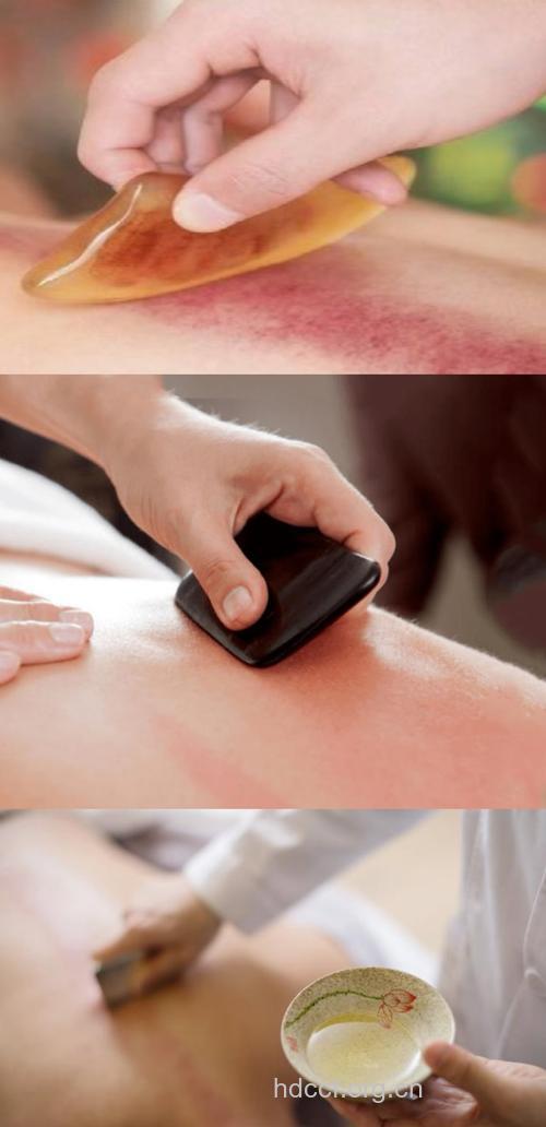 中医刮痧治疗8大病症