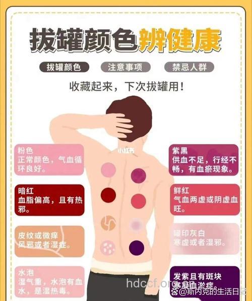 拔火罐的4个好处