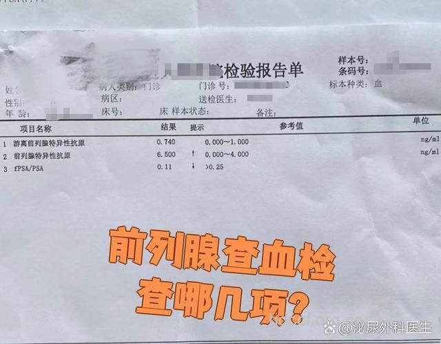 男士验血查特异性抗原可预知前列腺癌