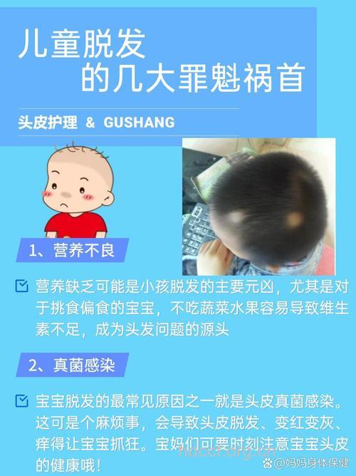 宝宝脱发是什么原因