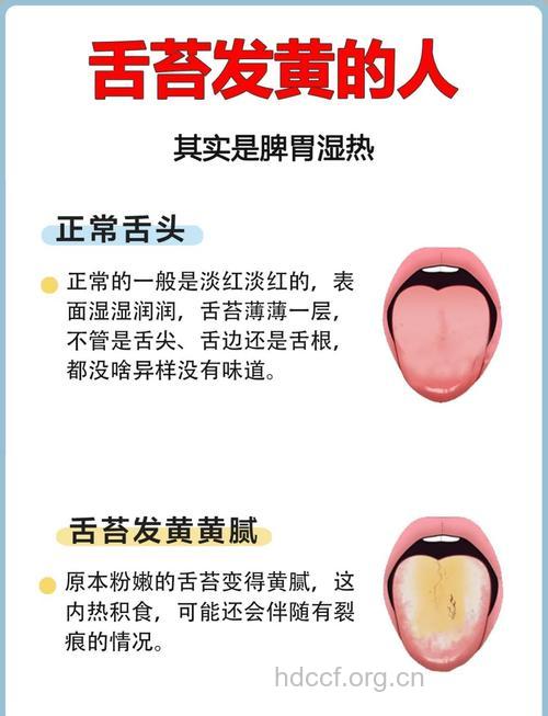 舌头黄是消化道出问题了吗 这些原因也会