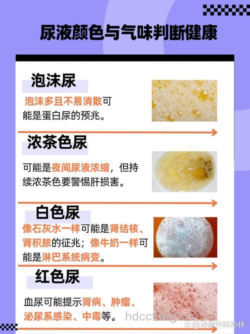 泡沫尿是肾虚吗 从尿液看肾脏健康