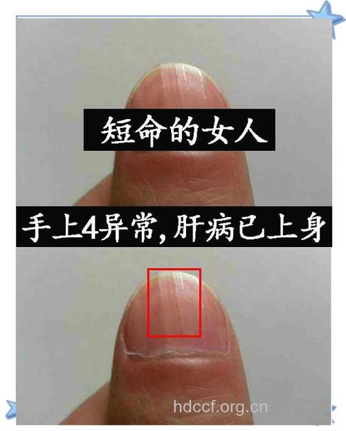 肝血好不好 看看你的指甲就知道