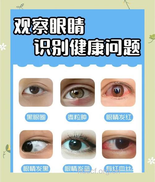 从眼部看健康 眼部有4个常见问题