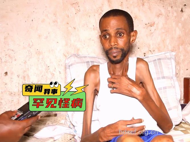 男性过瘦患癌的风险较高