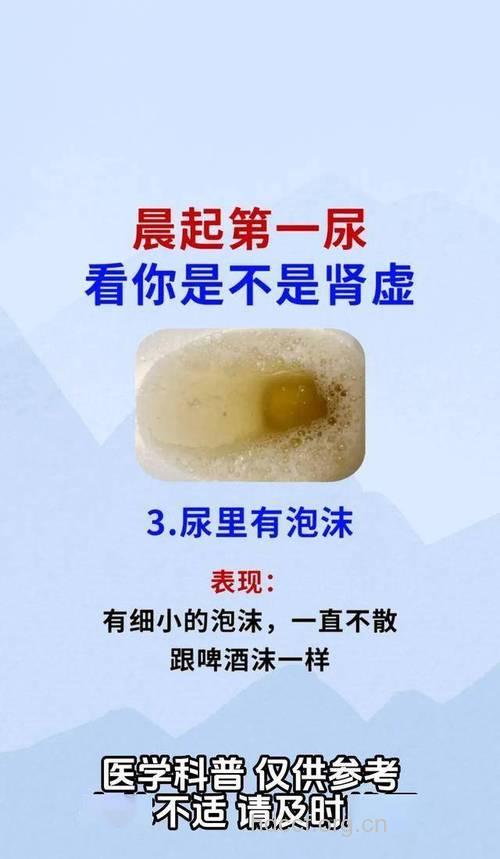 从清晨的第一泡尿 看身体是否健康